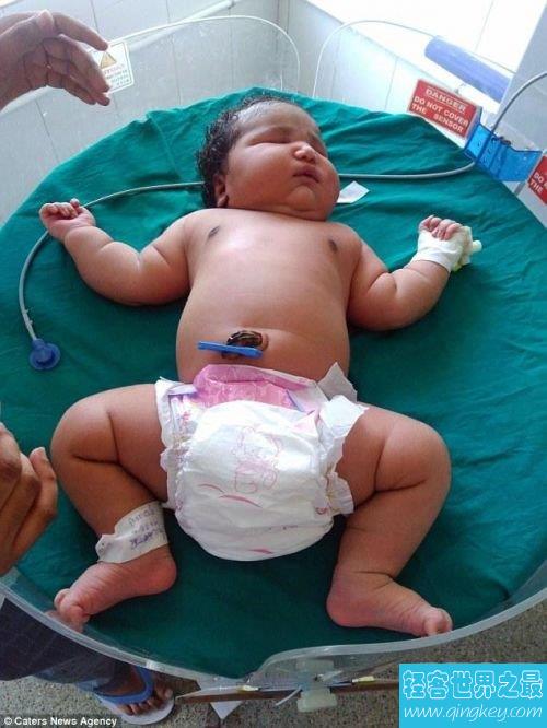 世界上最重的女婴，印度19岁女孩生13.6斤重巨婴
