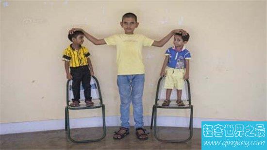 印度5岁男童身高1.75米，并不是基因突变造成的