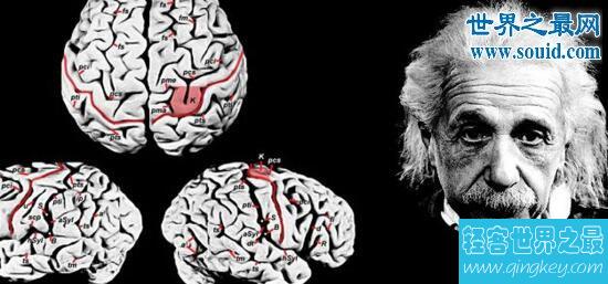 爱因斯坦的大脑，死后被偷走切成240片做研究