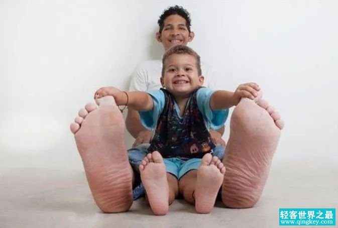 世界三最 最大的脚 最高夫妇 最多牙齿的人（奇特长相）