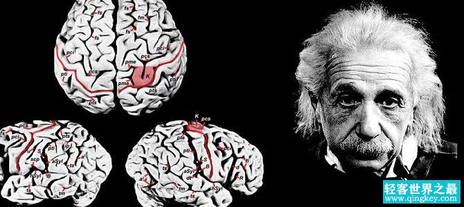 爱因斯坦大脑开发多少:13%,被切成约200片,研究43年