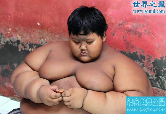 世界上最胖的孩子，10岁体重既达到384斤