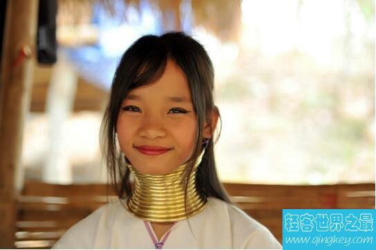 长颈族奇葩习俗导致脖子畸形，5岁开始戴1千克铜环
