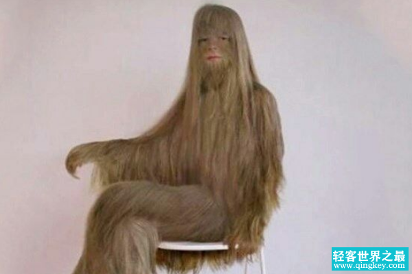 世界上最长的体毛:毛发似头发般生长(剃毛后变美女)