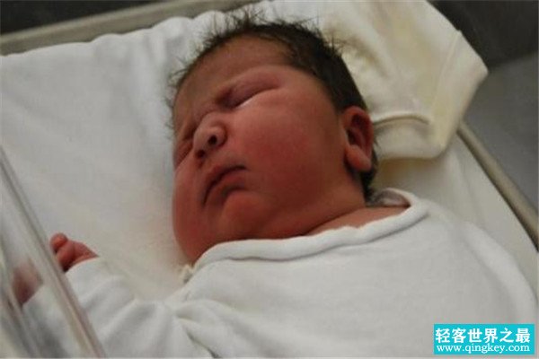 世界上最胖的宝宝在哪里 出生体重高达20斤（吉尼斯纪录）