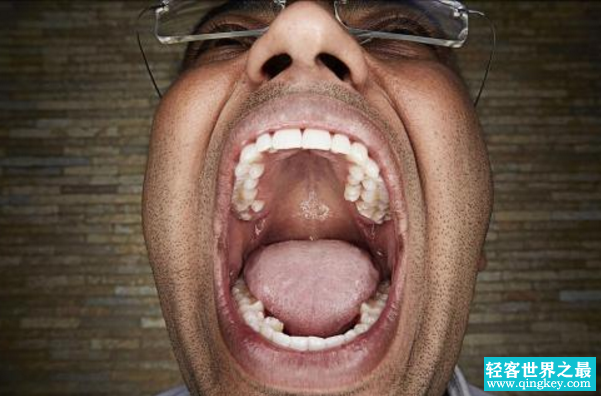 世界上牙齿最长的人，长17CM的巨牙是假新闻(最长3.67cm)