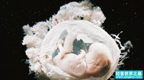 基因婴儿已经过去了几年的时间，为啥还遭到人类反对？